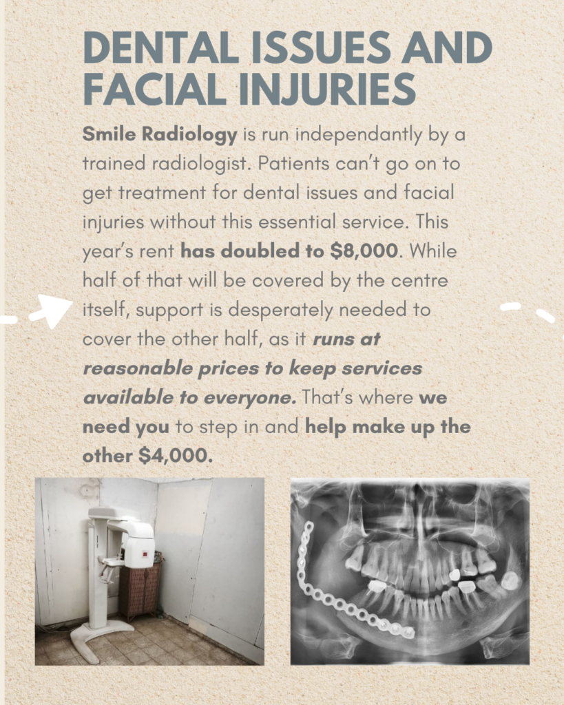 dental issues and facial injuries

Smile Radiology is run independantly by a trained radiologist. Patients can’t go on to get treatment for dental issues and facial injuries without this essential service. This year’s rent has doubled to $8,000. While half of that will be covered by the centre itself, support is desperately needed to cover the other half, as it runs at reasonable prices to keep services available to everyone. That’s where we need you to step in and help make up the other $4,000.

picture of a bare room with a medical device inside next to an X-ray of a jaw with some metallic items inside